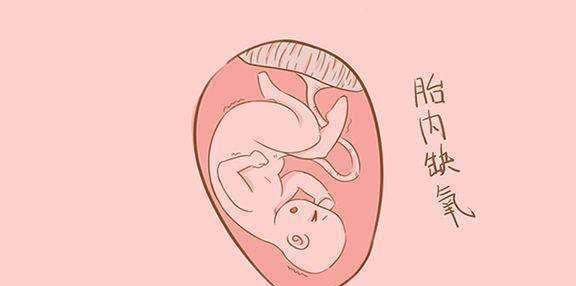 孕期常识:怎么判断胎儿是不是缺氧?3个方面早