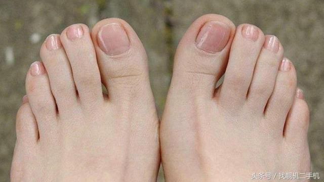 中国人的小脚趾,为什么都有两瓣指甲?