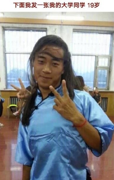 长相比实际年龄大是什么样的体验?21岁谢顶太