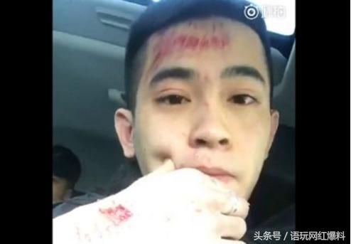 MC吴迪与MC祥龙的殴打事件中吴迪被打伤后