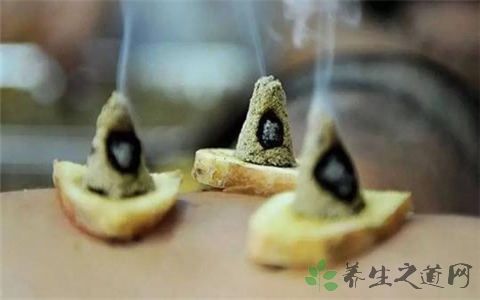 肾结石艾灸灸哪里