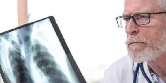 科普:周围型肺癌有什么样的征兆?看完心里有数