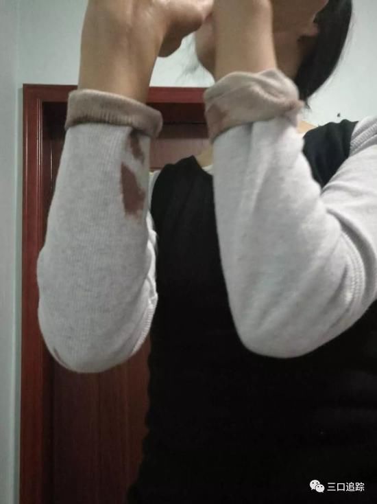 中传女硕士父亲春节遭村霸砍死:连砍3斧正中