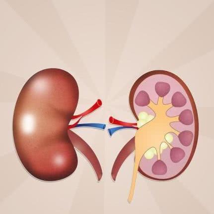 肾功能不全期肌酐升高该怎么应对?