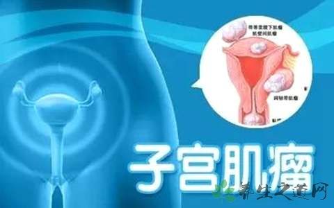 子宫肌瘤能吃阿胶吗