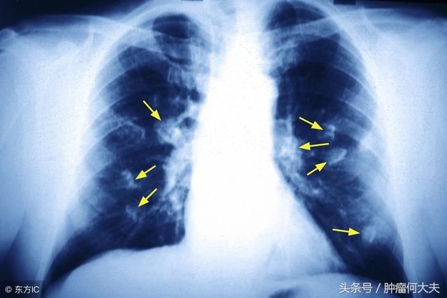 抽一滴血就能知道你患癌与否？2年后，这不再是一个“白日梦”!