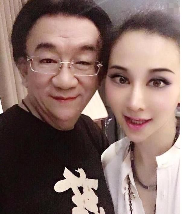 礼节性围观,症状混血美女安娜金主演三国性中暑肠胃与电影v症状的图片