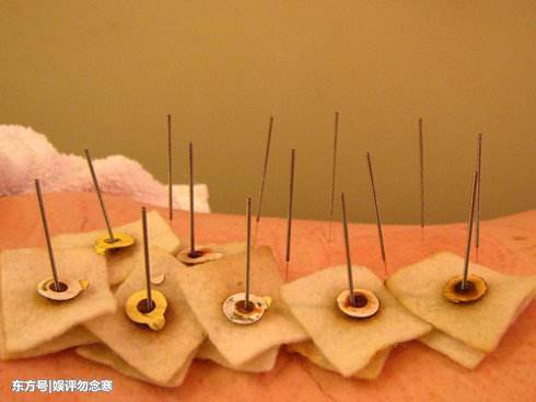 什么叫温针灸?针刺与艾灸相结合的一种方法