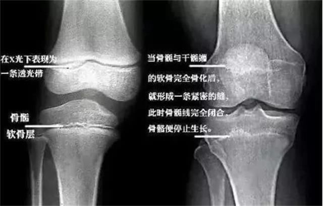 母婴    温馨提示:一旦发现小孩生长激素不足的症状一定要及时去医院